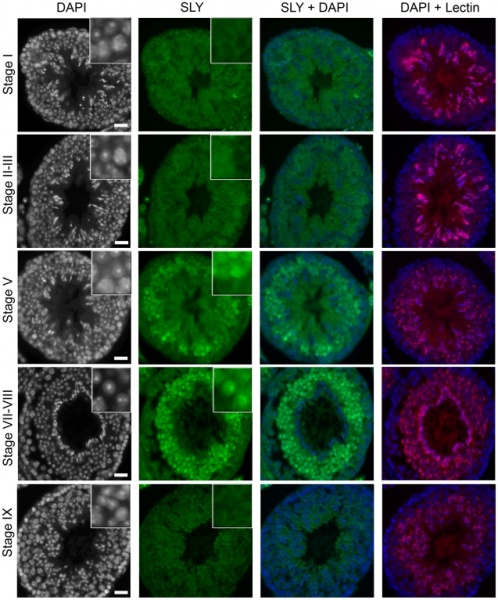 File:Mouse-spermatozoa SLY protein.jpg