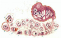 Fig 11 Drawing of cytotrophoblastic cells