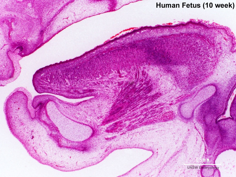 File:Human week 10 fetus 04.jpg