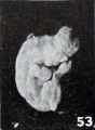 Figs. 52-63. Illustrating the absence of fundamental differences between the group of fetus compressus and grade 3 of the normal specimens. No. 532 (fig. 53) normal. Xl.8.