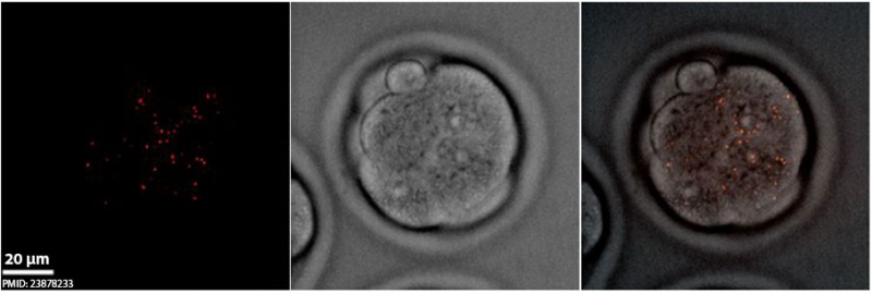 File:Spermatozoa mitochondria morula.jpg
