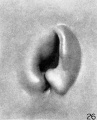 Fig. 26. Embryo No.1134e, 21.3 mm. long. X 24.