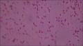 Non-viable spermatozoa