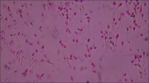 Non-viable spermatazoa.jpg