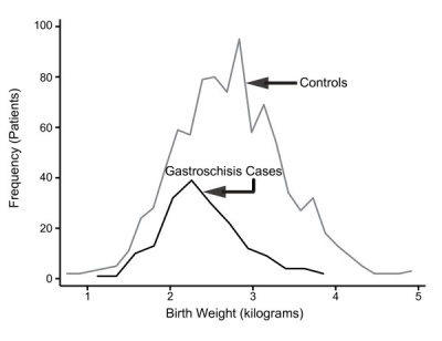Gastroschisis birth weight graph.jpg