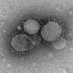 Middle East Respiratory Syndrome coronavirus (MERS-CoV) electron micrograph