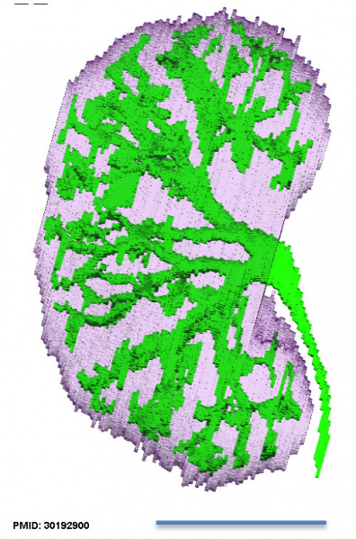 File:Human embryonic renal branching stage 22.jpg