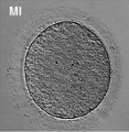 Human oocyte metaphase I