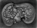 Fig 25 human embryo 11 mm