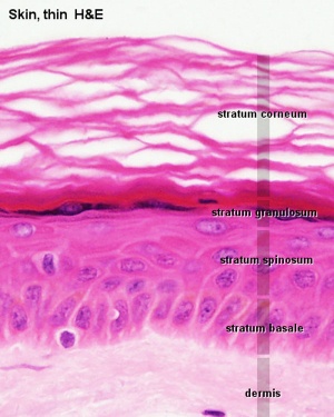 Adult epidermis histology 01.jpg
