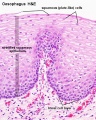 Oesophagus histology 04.jpg
