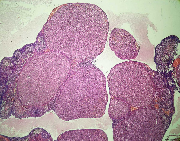 File:Rat ovary histology 01.jpg