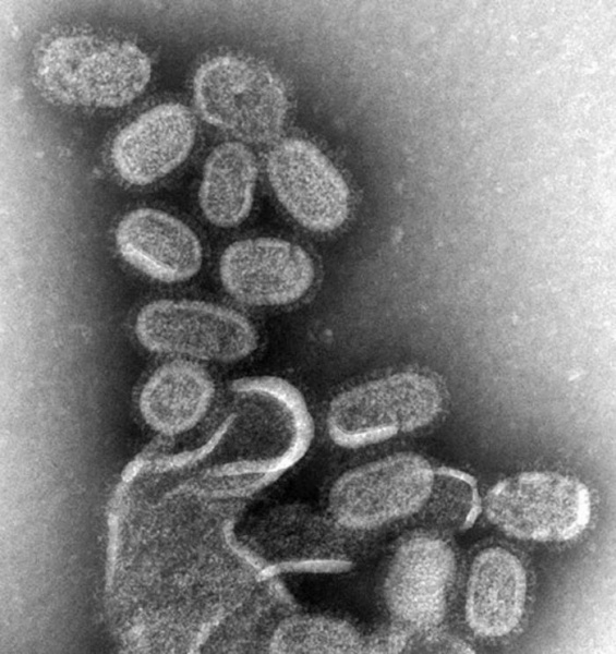 File:1918 influenza virus virions EM.jpg