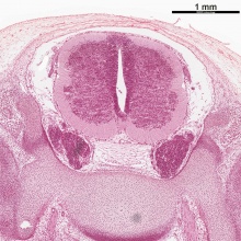 Human Stage22 spinal cord03.jpg