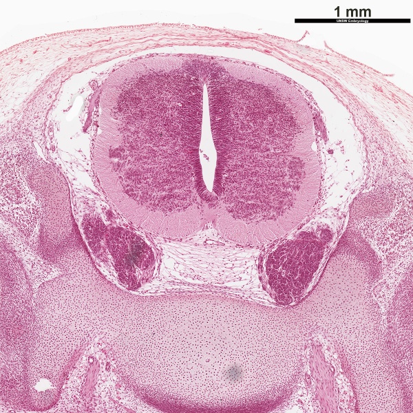 File:Human Stage22 spinal cord03.jpg