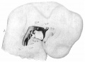 1902 Sudler Fig 4 Human pharynx