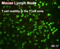 Mouse adult lymph node 02.jpg