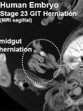 Stage23 MRI S04 icon.jpg