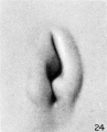 Fig. 24. No. 955, 17 mm. long. X 24.