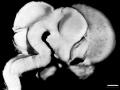 Fig 13 Left medial view of lateral embryonic CNS