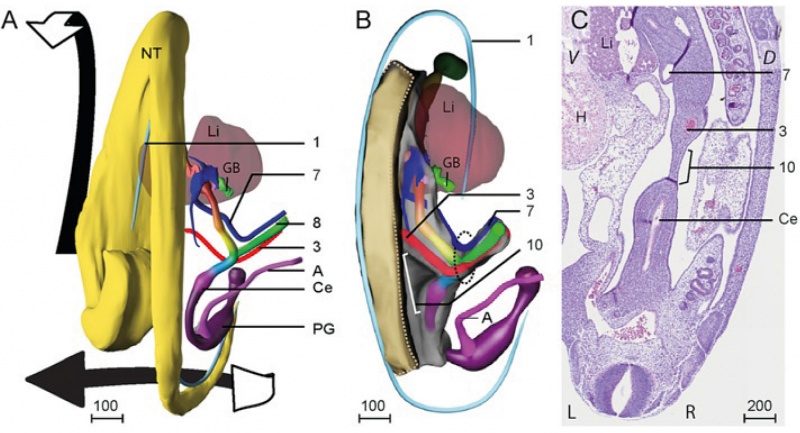 File:Human embryo midgut loop 01.jpg