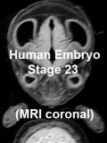 Stage23 MRI C01 icon.jpg