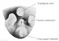 Fig. 637. Caudal end of the body of an embryo of 18 mm GL. Between the umbilicus, the coccygeal tubercle, and the right and left lower limbs is the cloacal tubercle; on its anal slope are the ostium urogenitale and the anal groove.