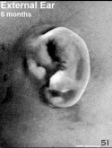 External Ear 5 months-icon.jpg