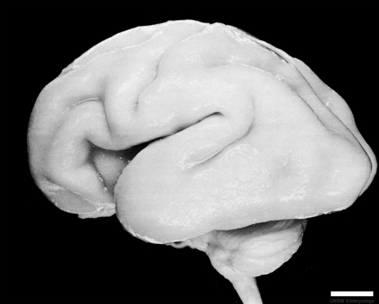File:Human Fetus CRL240mm brain.jpg