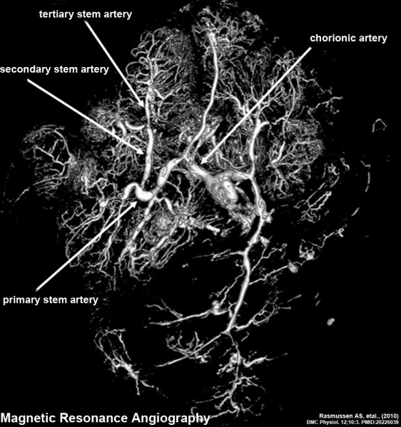 File:Human placenta vascular MRI 01.jpg