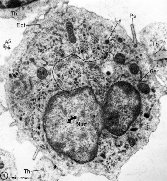 File:Monocyte EM01.jpg