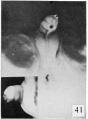 Fig. 41. Carnegie 1163, 68 mm Male (Insert, lateral)