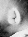 Fig. 28. Embryo No. 1535, 28 mm.