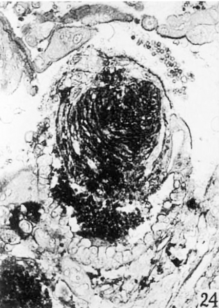 File:Brewer1937 fig24.jpg