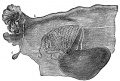Broad ligament of adult showing Epoöphoron