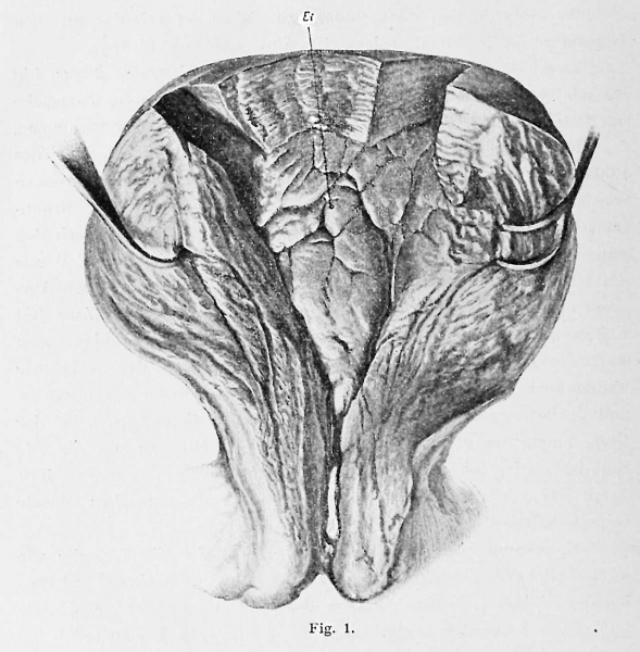 File:Peters1899 fig01.jpg