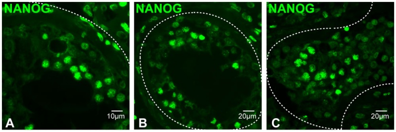 File:Human- spermatozoa NANOG expression.jpg