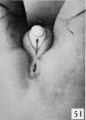 Fig. 51. No. 1455, 78 mm., female. X 4.