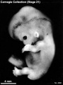 Embryo No. 4090 (left)