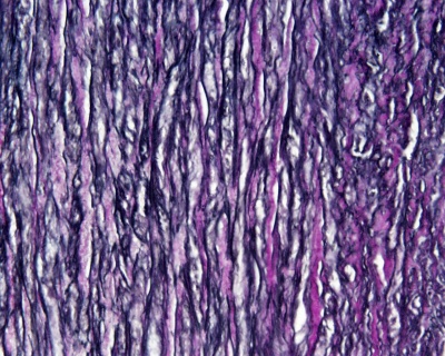 Artery histology 16.jpg