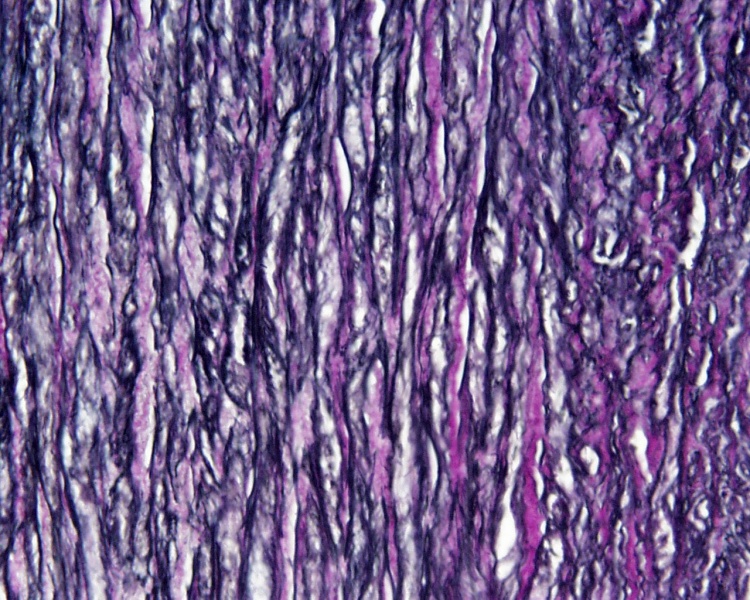 File:Artery histology 16.jpg