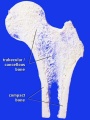 Bone structure