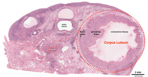 Ovary corpus luteum