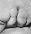 Fig. 14. Embryo No. 1767, 11 mm