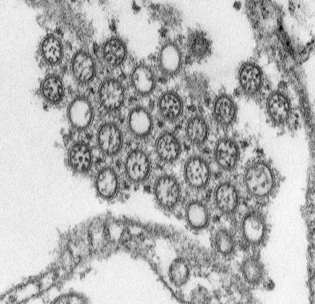 File:2009 influenza virus virions EM.jpg