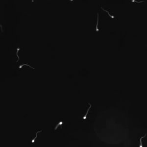Spermatozoa motility icon 01.jpg