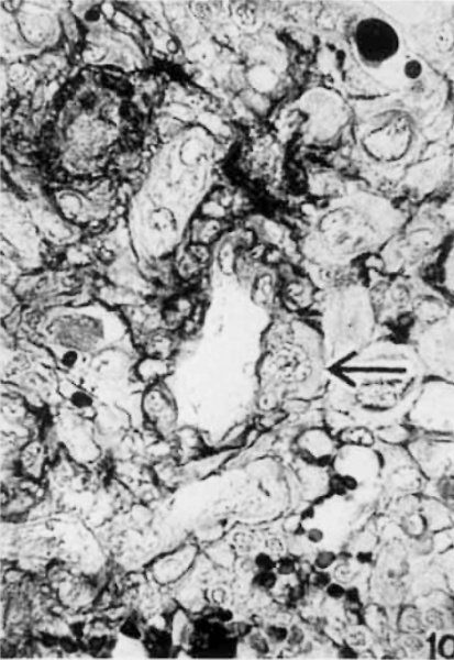 File:Brewer1937 fig10.jpg