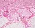 Pacinian corpuscle (unlabeled)
