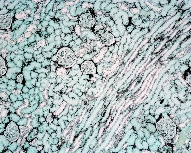 File:Renal histology 06.jpg