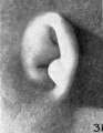 Fig. 31. No. 1840a, 38.5 mm. (R.)